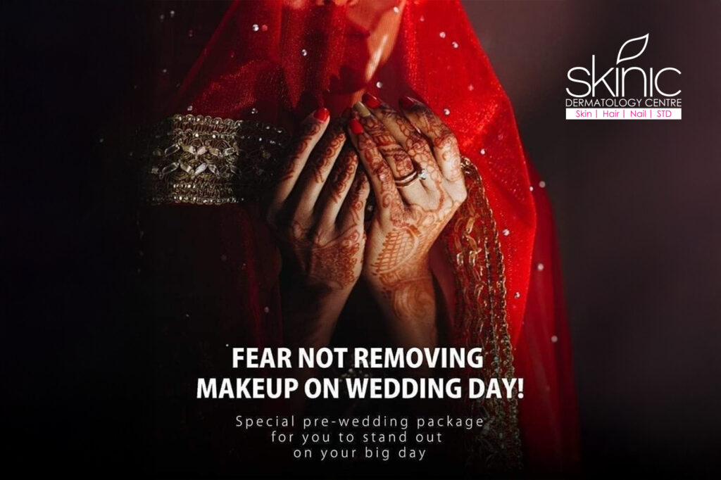Fear not removing makeup on wedding day