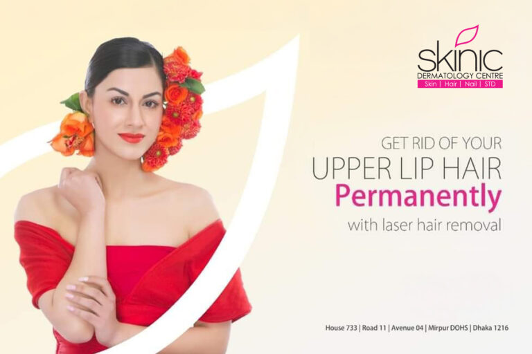 Upper lip hair remove permanently