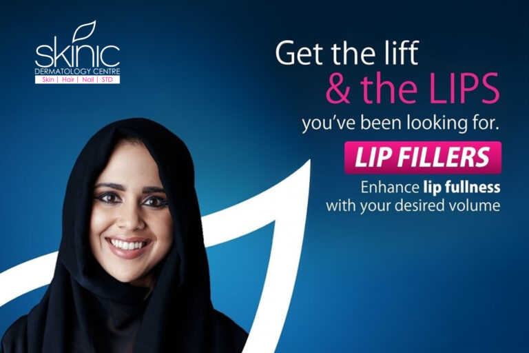 Lip Fillers